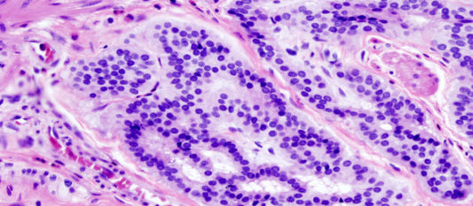 Mayer's Hematoxylin vs Harris Hematoxylin: What's the difference?