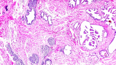 Top 10 Must-Have Consumables in a Pathology Lab