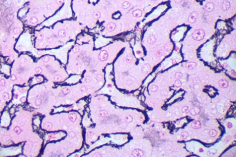 Gordon-Sweet for reticulum fibres 100 test - Special Stains