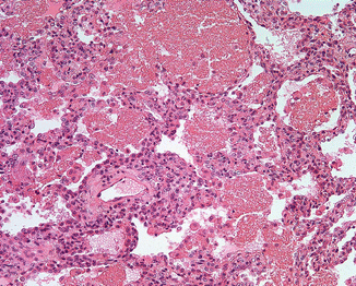 Pneumocystis Stain Control Slide - Cat# 356