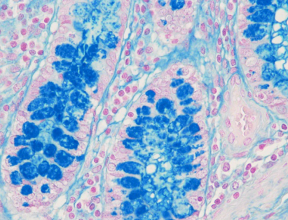 Colloidal Iron 100 test - Special Stains