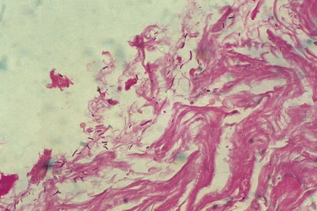 GRAM 100 test - Special Stains